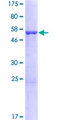 ANP32B Protein - 12.5% SDS-PAGE of human ANP32B stained with Coomassie Blue