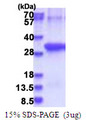 ANTXR2 / CMG2 Protein