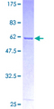 ANXA10 / Annexin A10 Protein - 12.5% SDS-PAGE of human ANXA10 stained with Coomassie Blue