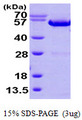 ANXA11 / Annexin XI Protein