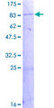 AOAH / Acyloxyacyl Hydrolase Protein - 12.5% SDS-PAGE of human AOAH stained with Coomassie Blue