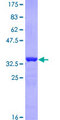 AP2B1 Protein - 12.5% SDS-PAGE Stained with Coomassie Blue.