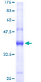 AP2S1 Protein - 12.5% SDS-PAGE of human AP2S1 stained with Coomassie Blue