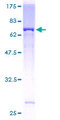 AP5Z1 Protein - 12.5% SDS-PAGE of human AP5Z1 stained with Coomassie Blue