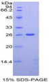 APC Protein - Recombinant Adenomatosis Polyposis Coli Protein By SDS-PAGE