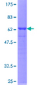 APOL3 / Apolipoprotein L 3 Protein - 12.5% SDS-PAGE of human APOL3 stained with Coomassie Blue