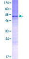 APOOL / Apolipoprotein O-Like Protein - 12.5% SDS-PAGE of human APOOL stained with Coomassie Blue