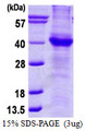 APP / Beta Amyloid Precursor Protein
