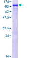 APPL2 Protein - 12.5% SDS-PAGE of human APPL2 stained with Coomassie Blue