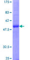 AQP2 / Aquaporin 2 Protein - 12.5% SDS-PAGE of human AQP2 stained with Coomassie Blue
