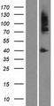 AR / Androgen Receptor Protein - Western validation with an anti-DDK antibody * L: Control HEK293 lysate R: Over-expression lysate