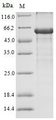 AR / Androgen Receptor Protein - (Tris-Glycine gel) Discontinuous SDS-PAGE (reduced) with 5% enrichment gel and 15% separation gel.