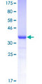 AR / Androgen Receptor Protein - 12.5% SDS-PAGE Stained with Coomassie Blue.