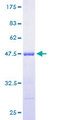ARF3 Protein - 12.5% SDS-PAGE of human ARF3 stained with Coomassie Blue