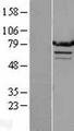 ARG99 / OLF Protein - Western validation with an anti-DDK antibody * L: Control HEK293 lysate R: Over-expression lysate