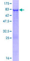 ARHGAP25 Protein - 12.5% SDS-PAGE of human ARHGAP25 stained with Coomassie Blue