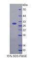 ARHGAP45 Protein - Recombinant Histocompatibility HA1, Minor (HMHA1) by SDS-PAGE