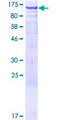 ARHGEF1 Protein - 12.5% SDS-PAGE of human ARHGEF1 stained with Coomassie Blue