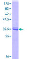 ARHGEF1 Protein - 12.5% SDS-PAGE Stained with Coomassie Blue.