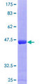 ARL4C Protein - 12.5% SDS-PAGE of human ARL4C stained with Coomassie Blue