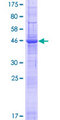 ARL6IP6 Protein - 12.5% SDS-PAGE of human ARL6IP6 stained with Coomassie Blue