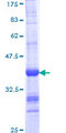 ARMC4 Protein - 12.5% SDS-PAGE Stained with Coomassie Blue.