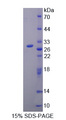 ARP5 / ANGPTL6 Protein - Recombinant  Angiopoietin Like Protein 6 By SDS-PAGE