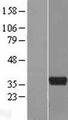 ART5 Protein - Western validation with an anti-DDK antibody * L: Control HEK293 lysate R: Over-expression lysate