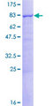 ATL3 Protein - 12.5% SDS-PAGE of human DKFZP564J0863 stained with Coomassie Blue