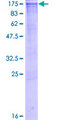 ATP2A2 / SERCA2 Protein - 12.5% SDS-PAGE of human ATP2A2 stained with Coomassie Blue