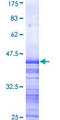 ATP2C1 Protein - 12.5% SDS-PAGE Stained with Coomassie Blue.