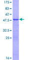ATP5H Protein - 12.5% SDS-PAGE of human ATP5H stained with Coomassie Blue