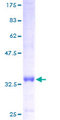 ATP5I Protein - 12.5% SDS-PAGE of human ATP5I stained with Coomassie Blue