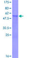 ATP6V1E2 Protein - 12.5% SDS-PAGE of human ATP6V1E2 stained with Coomassie Blue