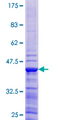 ATP6V1G1 / ATP6J Protein - 12.5% SDS-PAGE of human ATP6V1G1 stained with Coomassie Blue