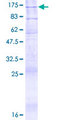 ATP9A Protein - 12.5% SDS-PAGE of human ATP9A stained with Coomassie Blue