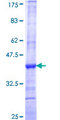 ATP9A Protein - 12.5% SDS-PAGE Stained with Coomassie Blue.