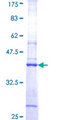 ATPAF2 Protein - 12.5% SDS-PAGE Stained with Coomassie Blue.