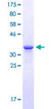 AVP / ADH / Vasopressin Protein - 12.5% SDS-PAGE Stained with Coomassie Blue.