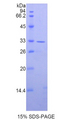 AXIN2 / Axin 2 Protein - Recombinant Axis Inhibition Protein 2 By SDS-PAGE