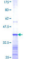 BAAT / BAT Protein - 12.5% SDS-PAGE Stained with Coomassie Blue.