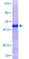 BAFF Receptor / CD268 Protein - 12.5% SDS-PAGE of human TNFRSF13C stained with Coomassie Blue