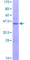 BBS10 Protein - 12.5% SDS-PAGE of human FLJ23560 stained with Coomassie Blue