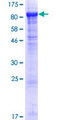 BBS2 / BBS Protein - 12.5% SDS-PAGE of human BBS2 stained with Coomassie Blue