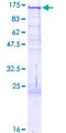BCAN / Brevican Protein - 12.5% SDS-PAGE of human BCAN stained with Coomassie Blue
