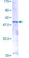 BCAS2 Protein - 12.5% SDS-PAGE of human BCAS2 stained with Coomassie Blue