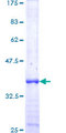 BCCIP Protein - 12.5% SDS-PAGE Stained with Coomassie Blue.