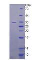 BCL11A Protein - Recombinant B-Cell CLL/Lymphoma 11A By SDS-PAGE