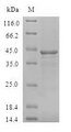 BCL2L15 Protein - (Tris-Glycine gel) Discontinuous SDS-PAGE (reduced) with 5% enrichment gel and 15% separation gel.