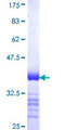 BCL6B Protein - 12.5% SDS-PAGE Stained with Coomassie Blue.